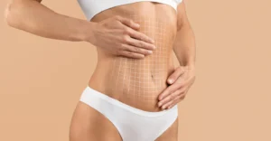 Read more about the article Real Success Stories: How Mitolyn Helped Me Lose 20 Pounds in 3 Months